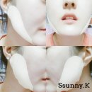 SY메디 | 메디앤서 콜라겐 리프트업 밴드