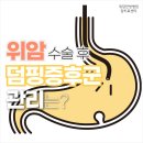 (주)위담 | 위암의 원인과 증상, 생존율과 치료율을 높이는 수술 후 덤핑증후군 관리법이 궁금합니다.