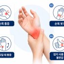 목동신경외과 손목 통증, 엄지손가락 움직일 때 손목이 아프다면 손목건초염