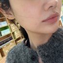 웨이브 온 | 강남 피부과에서 힐로웨이브 받고온 솔직한 후기