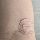 백세건강메디칼 이미지