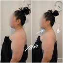 서에스테틱 | 청주율량동에스테틱 온바디 상체림프순환 후기