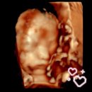 시약 | 임신23-26주 | 26주 임당 검사 통과 &amp; 입체 초음파 후기(공복 시간, 임당 시약 맛, 역아 자세)