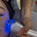 송촌장로교회 | 송촌동피부관리 플레이스킨 엑스터레이저 받고왔어요