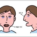 예스7치과의원 네이버블로그