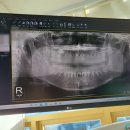 순천사랑치과의원 이미지