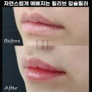 힐리브의원 이미지