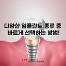 연제바른치과 이미지