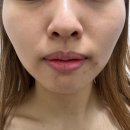 진스케어 이미지