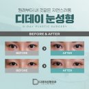 디데이성형외과의원 이미지