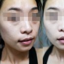 바른메디팜 네이버블로그