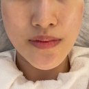 다드림약국 | [다드림 피부연구소] 봉천역 세멘시트 + 필로티 피부관리