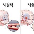 뇌졸중 뇌경색 뇌출혈 차이점? 허혈성 출혈성 초기(전조)증상 예방 방법 이미지