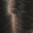 에스앤디케어 | 문제성 두피 관리하는방법에 대해 당신만 몰랐던 충격적인 사실