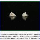 치아살리기 드림365치과의원 이미지