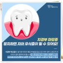 강북바를정치과의원 | 가오리역치과 치경부마모증과 치아시림 증상의 모든 것