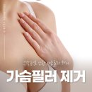 셀루오의원 이미지