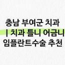 예플란트치과의원 | 부여군의 치과 정보, 강경치과의원, 예플란트치과의원 등