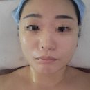 지티메디칼 | [광주] 효천지구 피부관리 재방문 예신관리 &#39;비온스킨&#39;