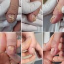 지에스25 도곡양재점 | 도곡역 대치역 양재역 물어뜯는 손톱 교정 연장 후기