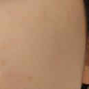 콜드플라즈마 이미지