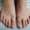 신세계 의수족 연구소 이미지