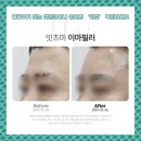 편편한의원 | 대전필러후기 찾는 것만큼이나 중요한 ‘이것’ 확인하세요