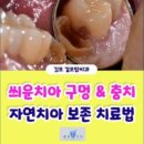 걸포탑치과의원 네이버블로그