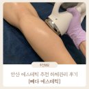 안산 다이어트 | 하체 비만, 하체 불균형 고민 해결! 하체관리 후기 : 빼다