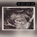 동학산 공원 | 임신 5주차 증상 초음파 동탄제일병원 초진 후기