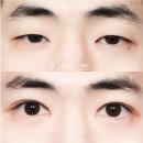 제로원성형외과의원 이미지