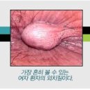 강북제일항외과