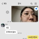 250516~250521 연차내고 강행한 직장인 라섹 수술 후기 1