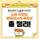도도독A | 서울·수도권 소아 선천성 방아쇠수지 증후군, 조기 진단과 수술 시기 가이드