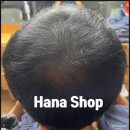 하나샵 | [ 할인행사 ] 하노이 미딩에 탈모 고민 해결! 자연스럽게 머리숱 채워주는 두피 문신 서비스 후기