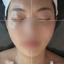 예하샵 | 주안피부관리 예하에스테틱 작은얼굴 윤곽관리 방문후기