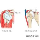 왼쪽 어깨 오른쪽 어깨 통증 원인 정리 이미지