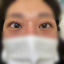 아이라이크(EYE LIKE) 이미지