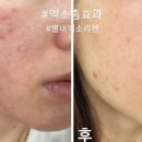 수니뷰티 네이버블로그