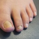 발산역 6번출구 옆 | 당신의 손발이 보내는 작은 신호발산역6번출구 ‘여우콩네일’에서 문제성손발관리를 받다