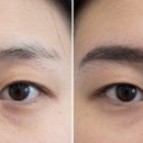 닥터홍이비인후과의원 | 닥터홍 성형외과에서 완성한 또렷한 눈썹이식 후기 대공개