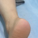 시월네일 | 행신 패디플래닝 제대로 받고 온 시월네일 발각질관리 후기