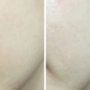 스파두이 (SPA DU2)
