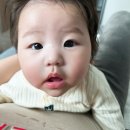 4개월 아기 2차예방접종 후기 | 부작용 없이 지나갈까