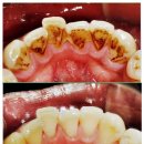 소은희마인드피아의원 | 삼성역치과 과잉진료 없는 양심적인 진료 임플란피아치과