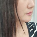 안심의원 | 잠실새내역 피부과 베러미의원 온다리프팅 후!! 자연스러운 탄력 리프팅 리얼 후기