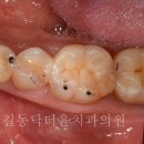 윤치과기공소 이미지