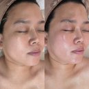조타 생활과학연구소 | 울산 웨이브온 리프팅 노진희피부연구소 온다 느낌 3회차 후기