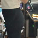 신사역5번출구 | 신사역 허벅지 지방추출 무한용량 주사 스마일스 일주일 후기