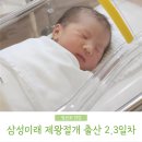 삼성종합의료기 | 제왕절개 출산 2일차 3일차 운동 모유수유 교육 시작